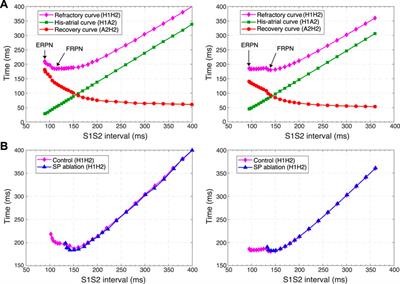 A compact multi-functional model of the rabbit atrioventricular node with dual pathways